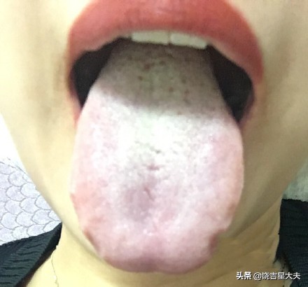 老中医讲透舌诊，解密舌根部藏着的妇科、男科疾病的秘密