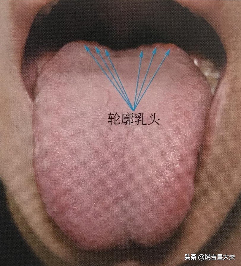 正常人的舌根两侧图片图片